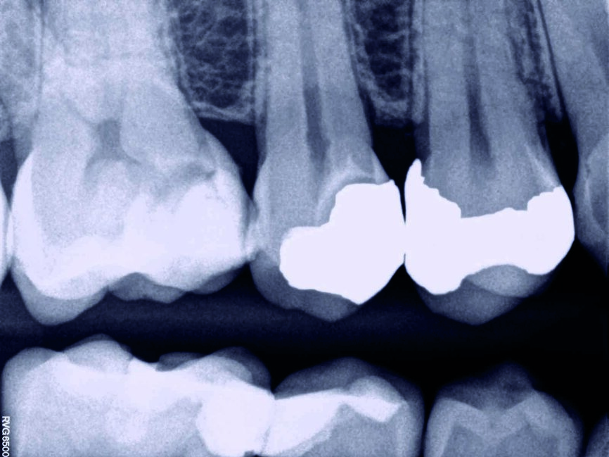 Fig. 10