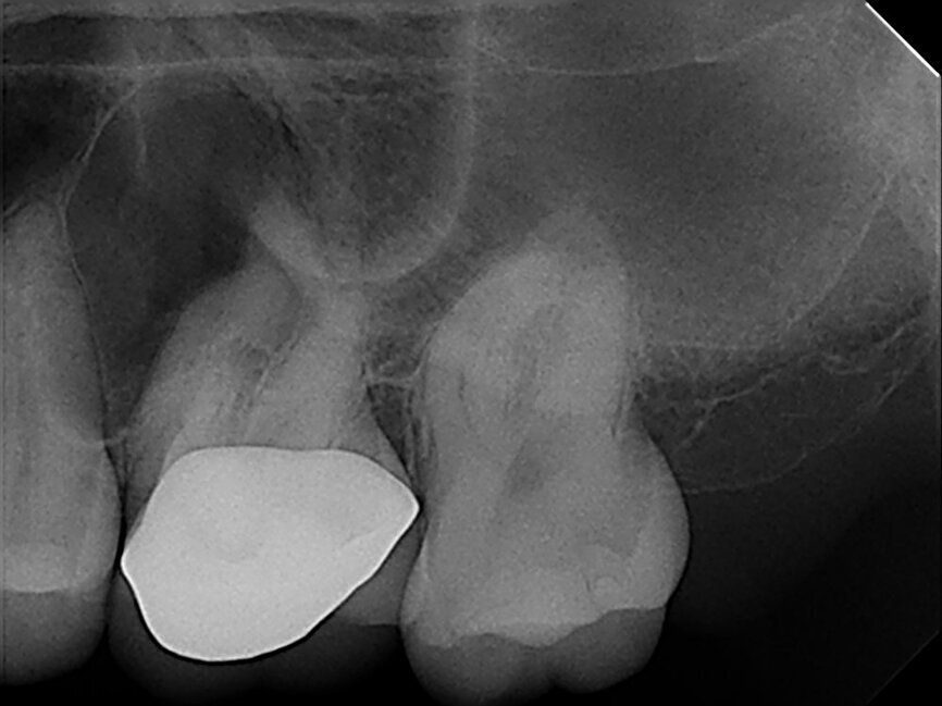 Fig.: 1