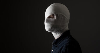 Facial transplant surgery improves speech in patient with severe facial trauma, study finds
