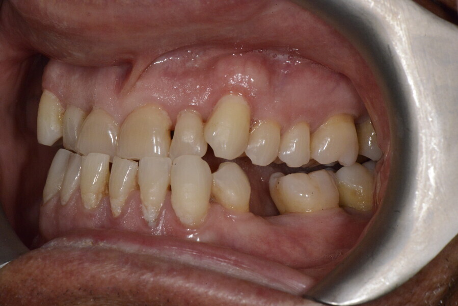 Fig. 11e