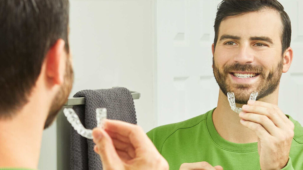 Hàm duy trì chỉnh nha SureSmile: Được thiết kế để giữ răng tại chỗ