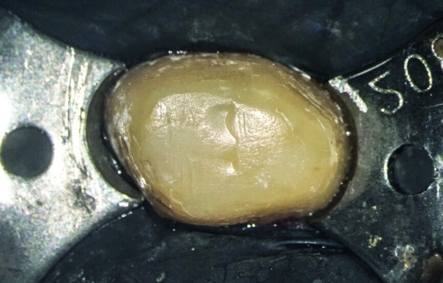 Fig.: 8