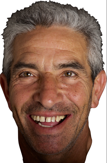 Fig. 1