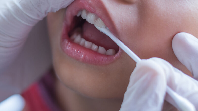 Fluoride varnish in primary dentition positively affects caries prevention