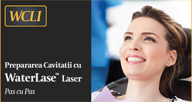 Prepararea cavitatii cu laser pas cu pas