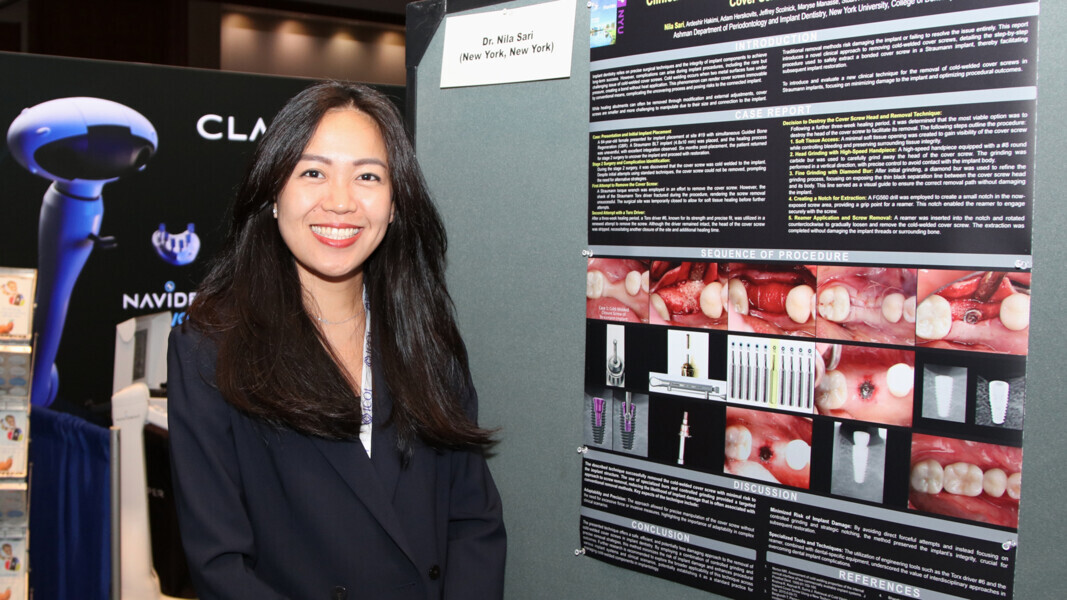 Among the many excellent poster presentations was this one on techniques for the removal of cold-welded Straumann cover screws in clinical practice. 
