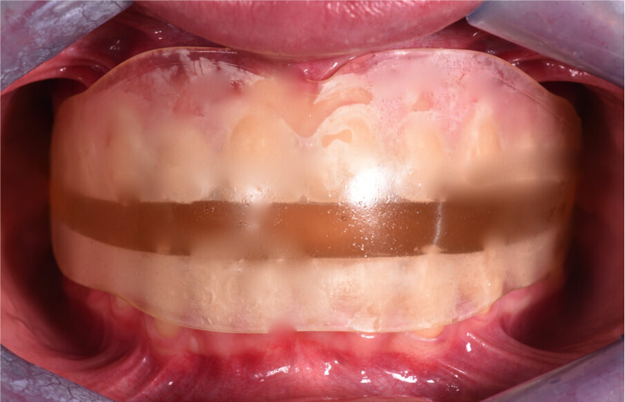 Fig. 6