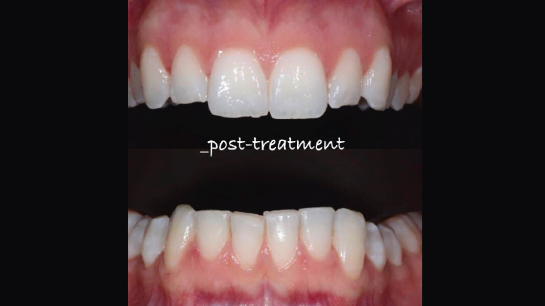 Fig. 16 - Risultato post trattamento.