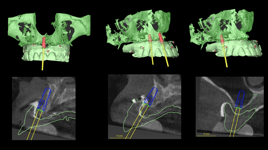 Fig. 3