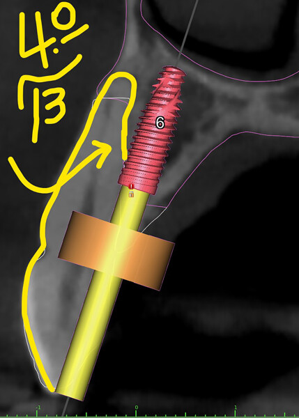 Fig. 5c