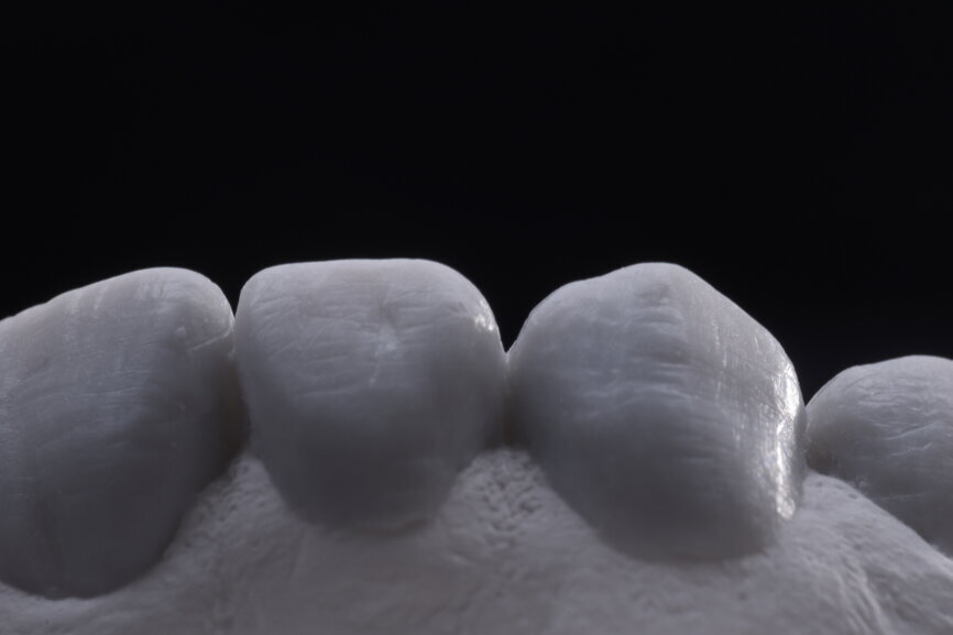Fig. 31: Final wax-up of all units.