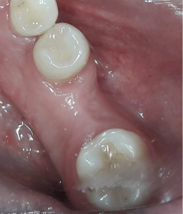 Fig. 1a