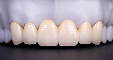 The growing opportunity in anterior esthetic dentistry