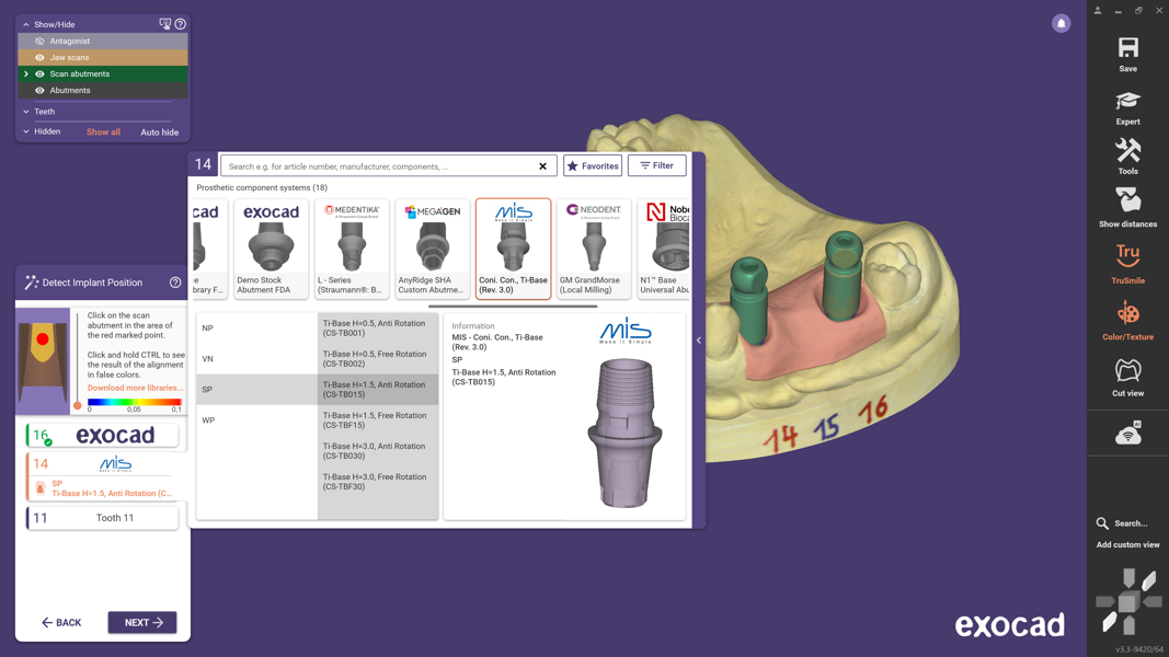 Fig. 2: Compatible component sub-selections are displayed clearly for the chosen implant system, supported by a preview model that visualises the implant connection.