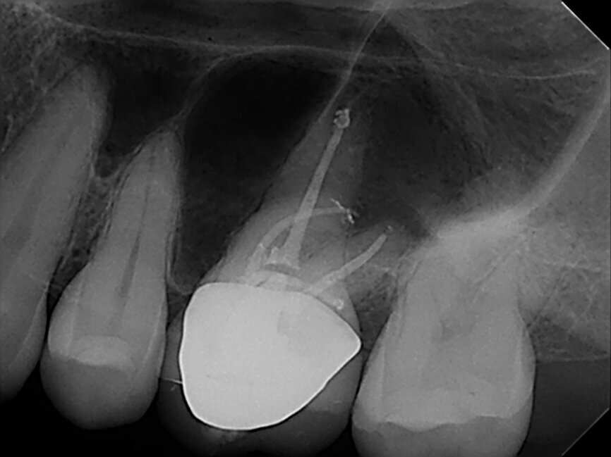 Fig.: 2