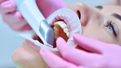 Intra-oral scanning: Current capabilities and ongoing developments