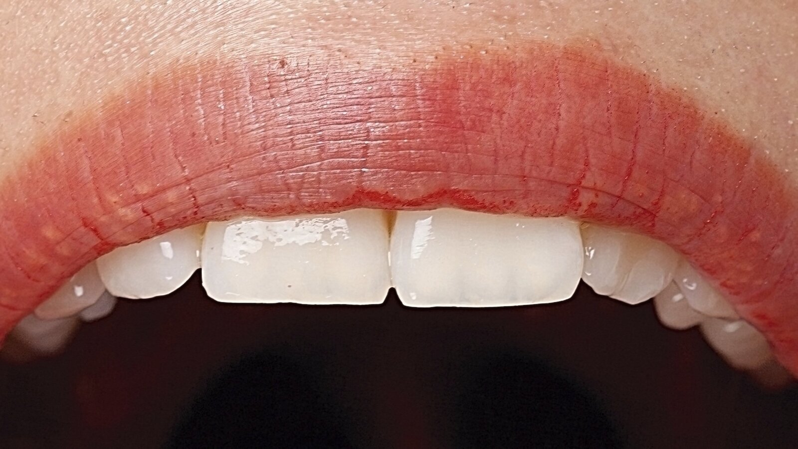 El paciente con cáncer oral: Guía clínica para su atención odontológica (3)