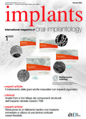 implants Italy No.1, 2022
