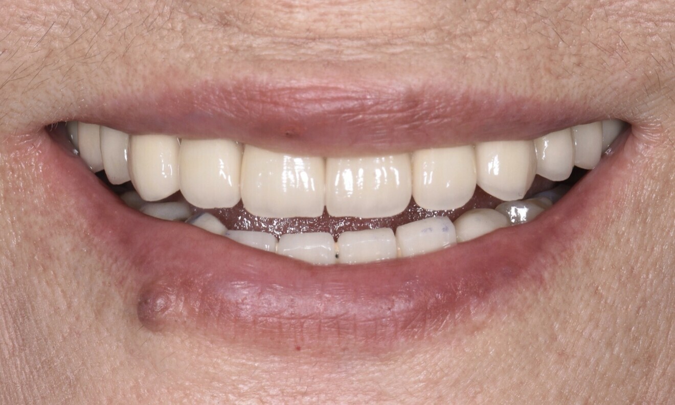 Fig. 13
