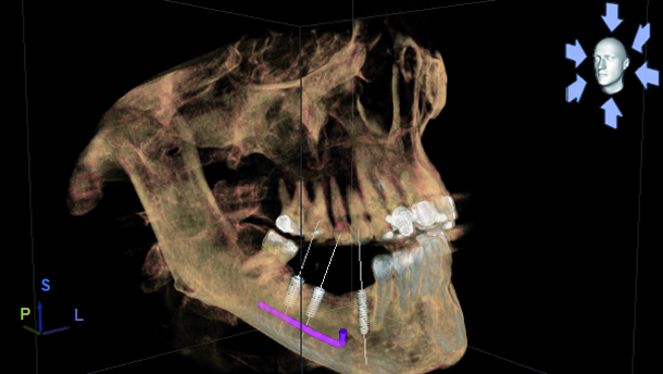 The 3-D difference: CBCT diagnostics to enhance treatment—Part 1