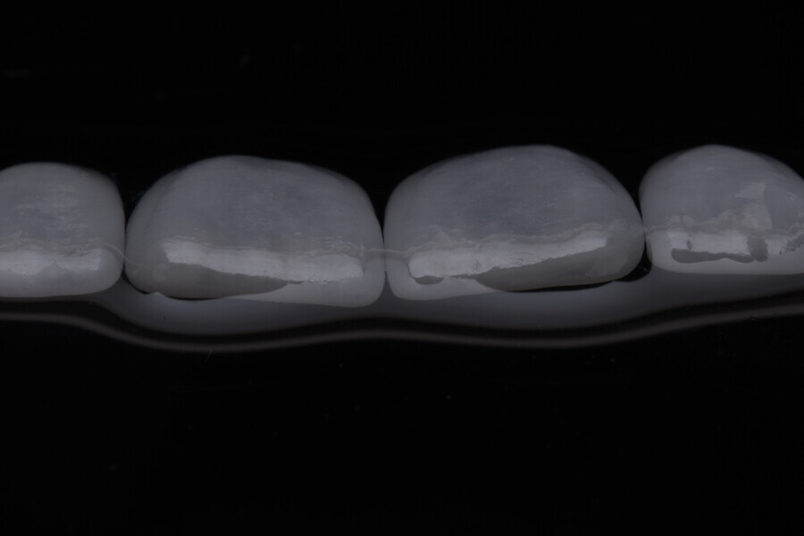 Fig. 14b.