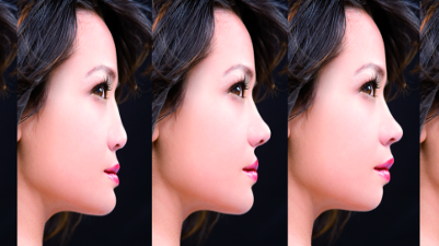 Smile analysis and photoshop smile design technique