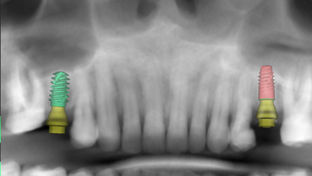 Fig. 5e