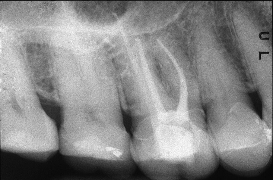 Fig. 1c