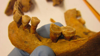 Estudo da placa medieval mostra como os microbiomas bucais mudaram
