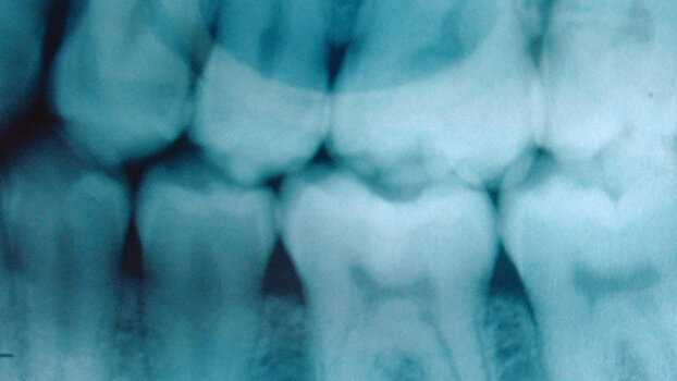 Dental tissue engineering products in the US market to double by 2015