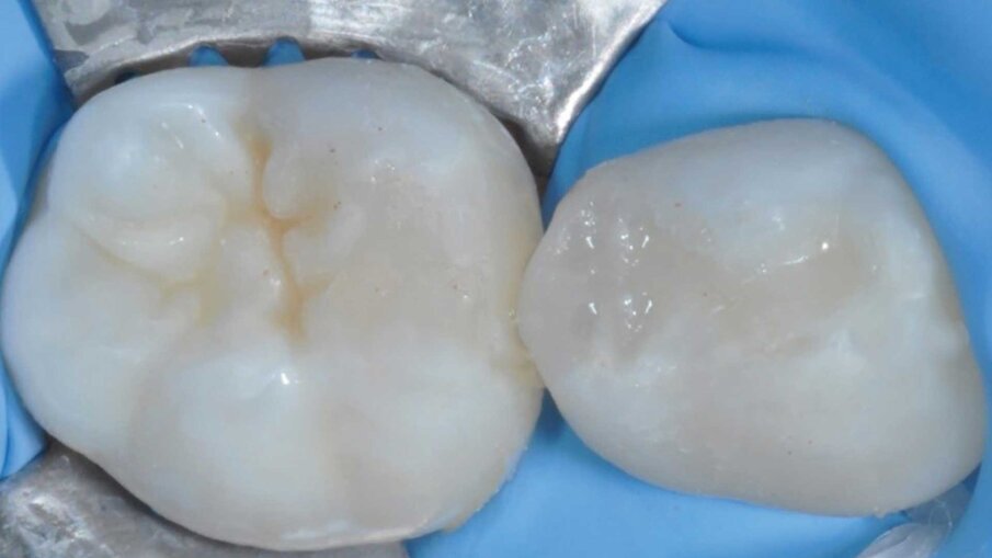 Fig. 4