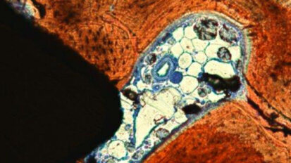 Un accenno all’osteointegrazione in breve, ossia sulla “connessione diretta, strutturale e funzionale, fra osso vitale e la superficie di un impianto caricato” (Branemark)