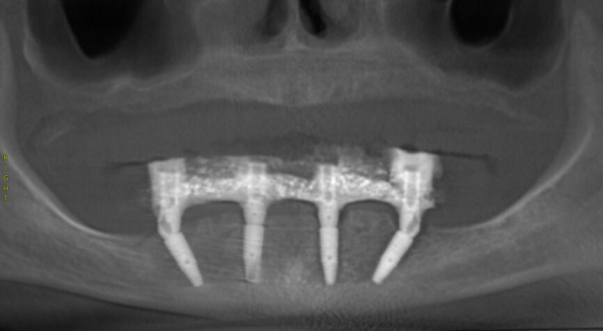 Fig. 24