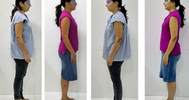 A Clinical Observation: Relation Between Dental Occlusion & Posture