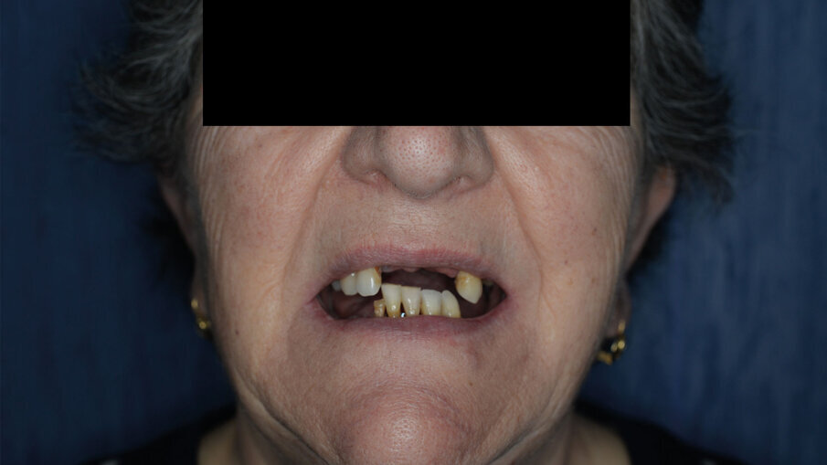 Fig. 1