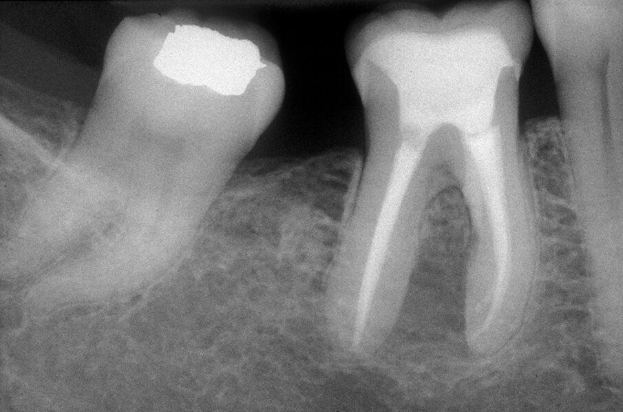 Fig. 3i