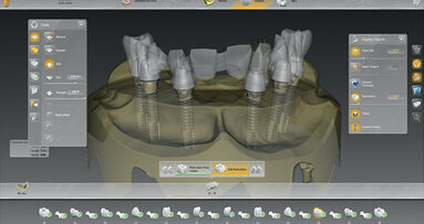 Nuovo Software: INLAB 15.0 “un software alla ricerca dell’arte odontotecnica”