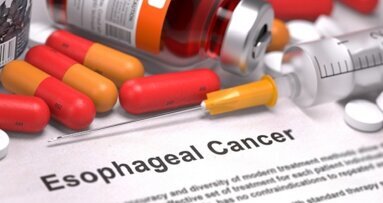 Periodontal disease bacteria linked to esophageal cancer