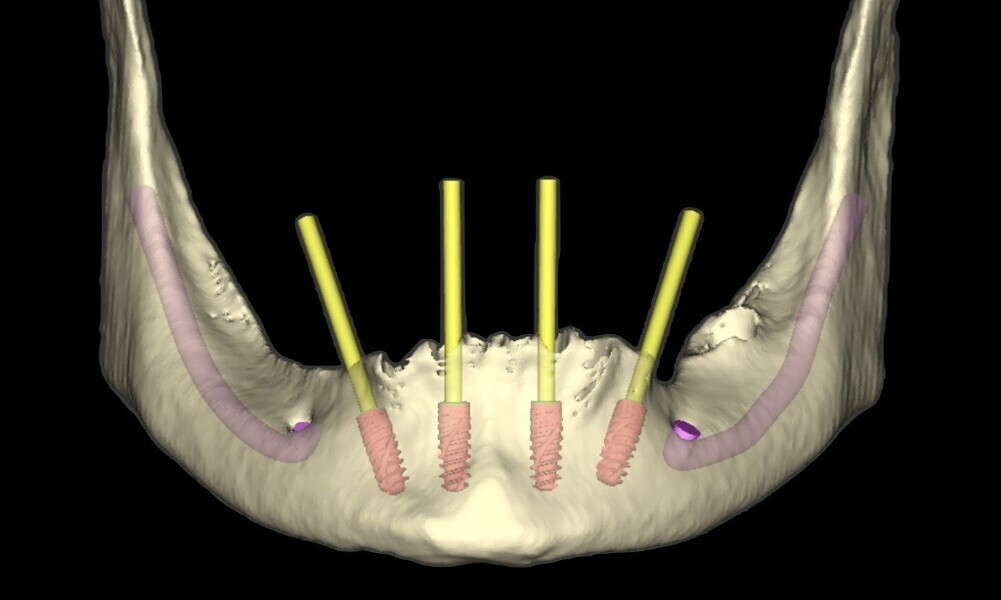 Fig. 18