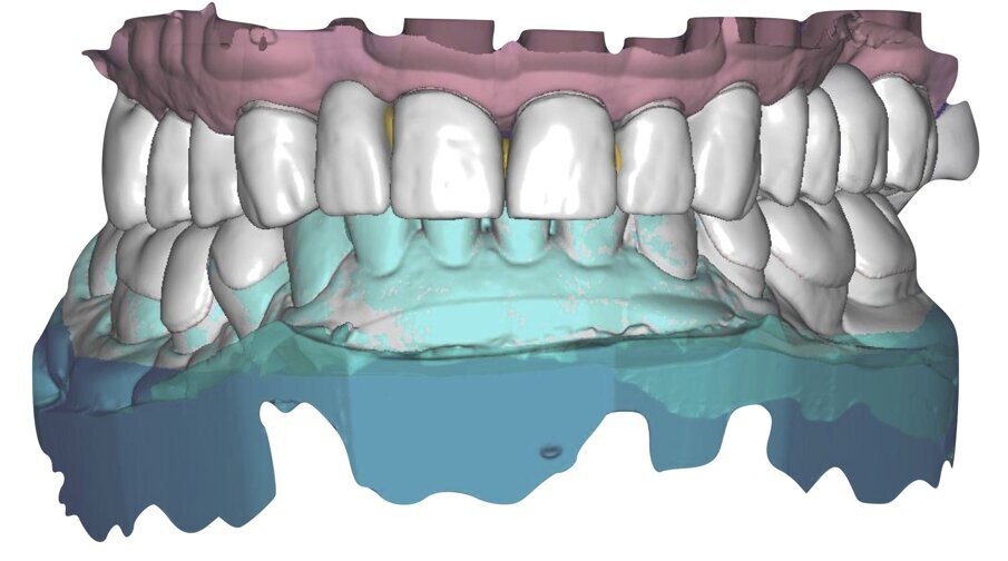 Fig. 30