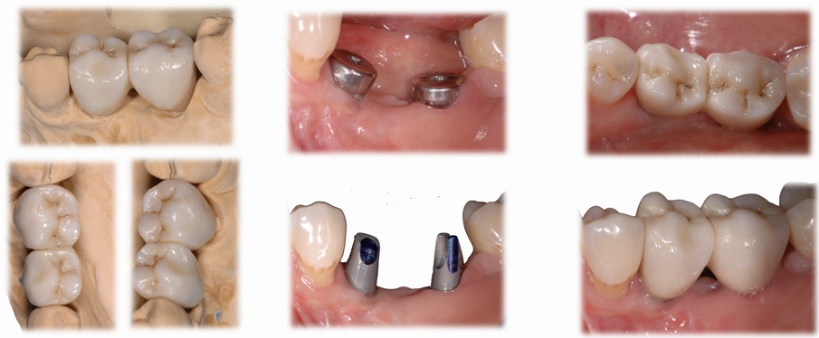 Fig. 16