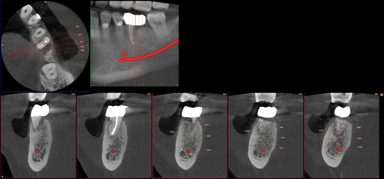 Fig. 14