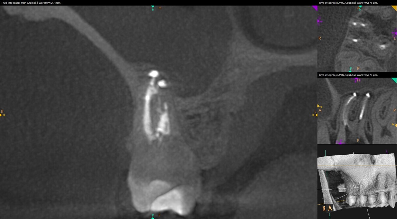 Fig. 14