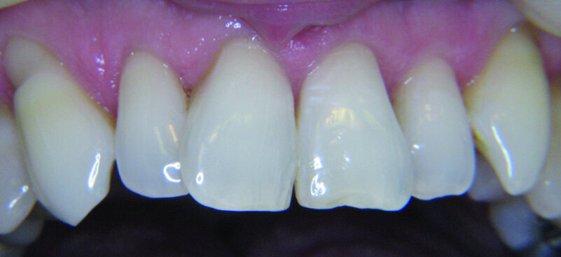 Figure 14a