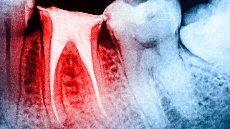 X Congresso Internazionale AIO, a Chia l’indagine in endodonzia si colora di “giallo”