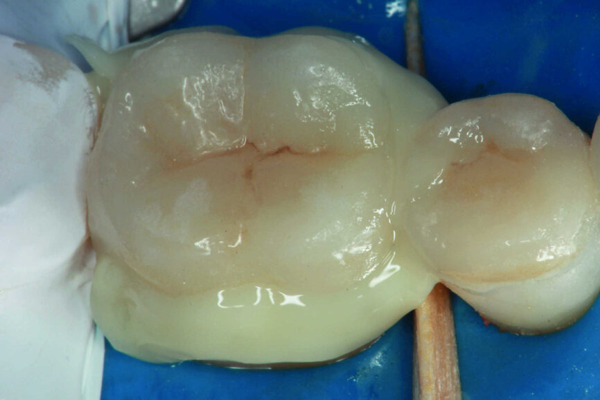 Fig.17