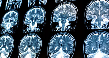 New evidence suggests possible link between brain function and oral health