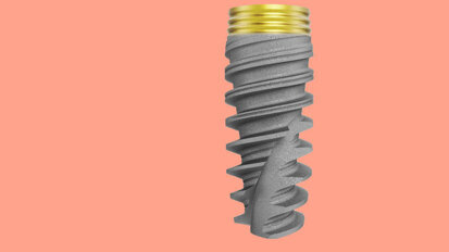 “Science, stability, success”: Dr Graham Carmichael discusses Xeal and TiUltra surfaces
