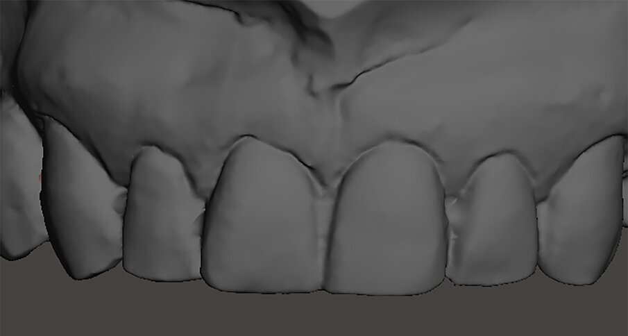 Fig. 10g