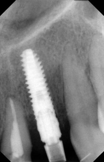 Fig. 16